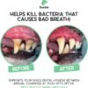 Barkle Dog Teeth Cleaning Gel | Best Dog Tooth Brushing Kit | Vet Reviewed to Eliminate Plaque, Tartar & Bad Breath | Toothpaste Replacement | Dog Breath Freshener | Free Finger Brush (Mint - 60 Days) - Image 2